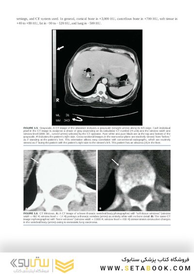 Brant & Helms' Fundamentals of Diagnostic Radiology:  Sixth Edition