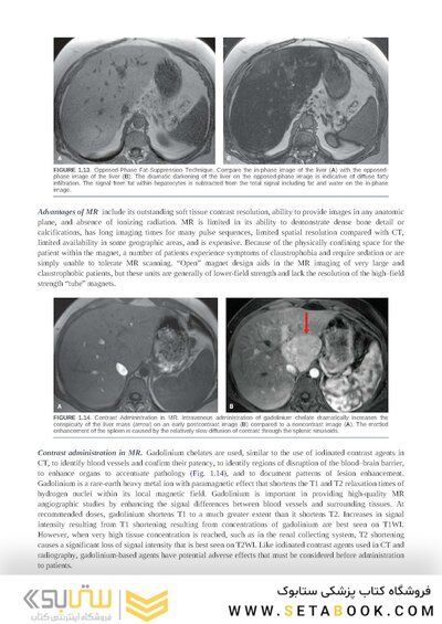 Brant & Helms' Fundamentals of Diagnostic Radiology:  Sixth Edition