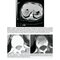 Brant & Helms' Fundamentals of Diagnostic Radiology:  Sixth Edition
