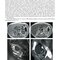 Brant & Helms' Fundamentals of Diagnostic Radiology:  Sixth Edition