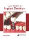 Case Studies in Implant Dentistry