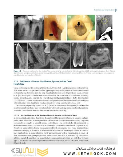 Endodontic Advances and Evidence-Based Clinical Guidelines 1st Edition