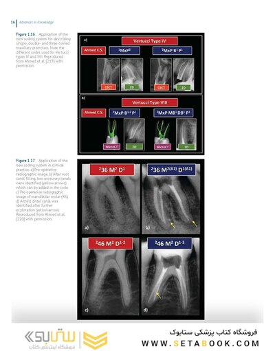 Endodontic Advances and Evidence-Based Clinical Guidelines 1st Edition