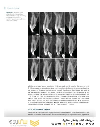 Endodontic Advances and Evidence-Based Clinical Guidelines 1st Edition