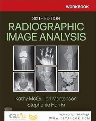 Workbook for Radiographic Image Analysis 6th Edition
