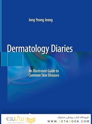 Dermatology Diaries: An Illustrated Guide to Common Skin Diseases