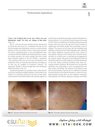 Dermatology Diaries: An Illustrated Guide to Common Skin Diseases