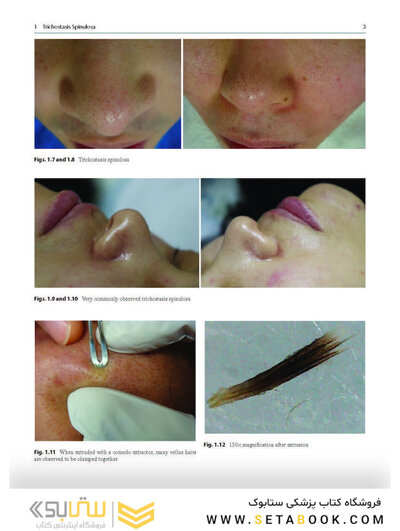Dermatology Diaries: An Illustrated Guide to Common Skin Diseases