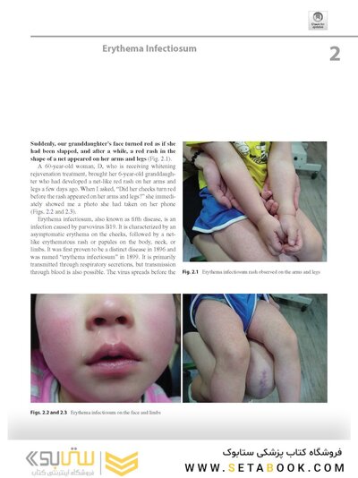 Dermatology Diaries: An Illustrated Guide to Common Skin Diseases