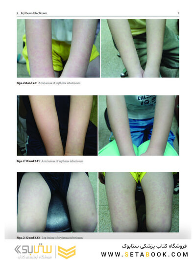 Dermatology Diaries: An Illustrated Guide to Common Skin Diseases
