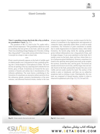 Dermatology Diaries: An Illustrated Guide to Common Skin Diseases