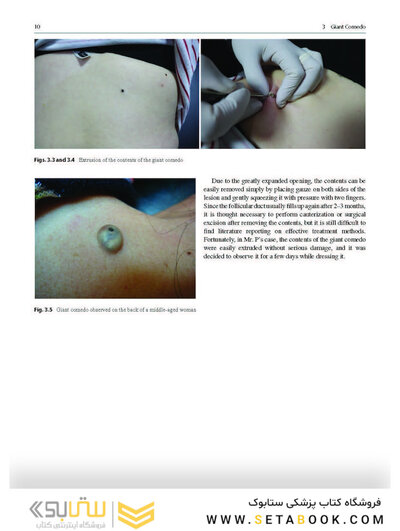 Dermatology Diaries: An Illustrated Guide to Common Skin Diseases