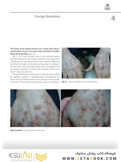 Dermatology Diaries: An Illustrated Guide to Common Skin Diseases