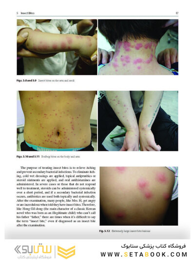 Dermatology Diaries: An Illustrated Guide to Common Skin Diseases