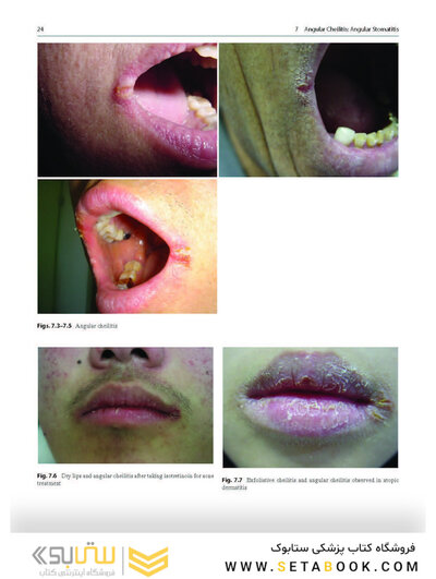 Dermatology Diaries: An Illustrated Guide to Common Skin Diseases