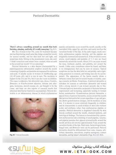 Dermatology Diaries: An Illustrated Guide to Common Skin Diseases