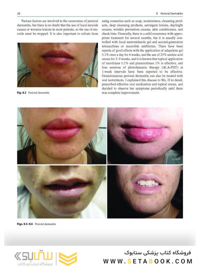Dermatology Diaries: An Illustrated Guide to Common Skin Diseases