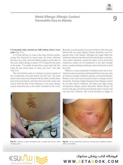 Dermatology Diaries: An Illustrated Guide to Common Skin Diseases