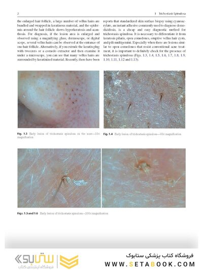 Dermatology Diaries: An Illustrated Guide to Common Skin Diseases