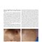 Dermatology Diaries: An Illustrated Guide to Common Skin Diseases