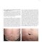 Dermatology Diaries: An Illustrated Guide to Common Skin Diseases