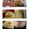Dermatology Diaries: An Illustrated Guide to Common Skin Diseases