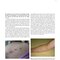 Dermatology Diaries: An Illustrated Guide to Common Skin Diseases