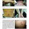 Dermatology Diaries: An Illustrated Guide to Common Skin Diseases