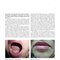 Dermatology Diaries: An Illustrated Guide to Common Skin Diseases