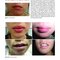 Dermatology Diaries: An Illustrated Guide to Common Skin Diseases