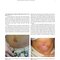 Dermatology Diaries: An Illustrated Guide to Common Skin Diseases