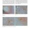 Dermatology Diaries: An Illustrated Guide to Common Skin Diseases