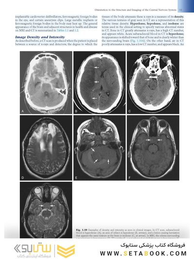 Fundamental Neuroscience for Basic and Clinical Applications 6th Edition