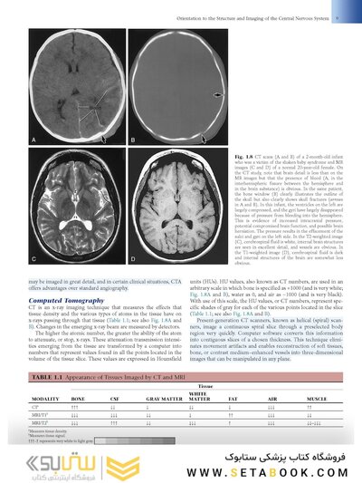 Fundamental Neuroscience for Basic and Clinical Applications 6th Edition