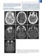 Fundamental Neuroscience for Basic and Clinical Applications 6th Edition