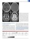 Fundamental Neuroscience for Basic and Clinical Applications 6th Edition