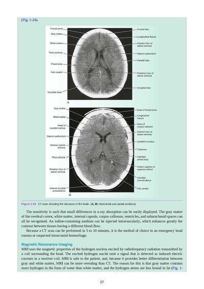 Snell's Clinical Neuroanatomy Ninth Edition