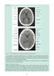 Snell's Clinical Neuroanatomy Ninth Edition