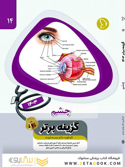 گزینه برتر چشم 1403