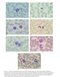 Hoffbrand's Postgraduate Haematology 8th Edition