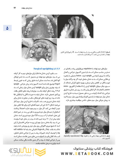 اصول جراحی دهان، فک و صورت پیترسون 2022 - جلد دوم