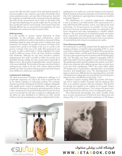 Contemporary Orthodontics 7th Edition