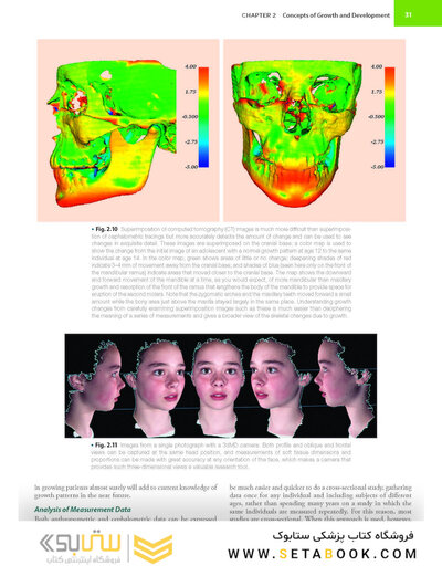 Contemporary Orthodontics 7th Edition