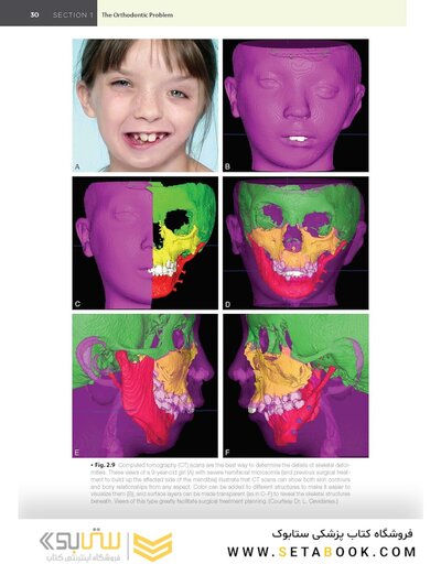 Contemporary Orthodontics 7th Edition