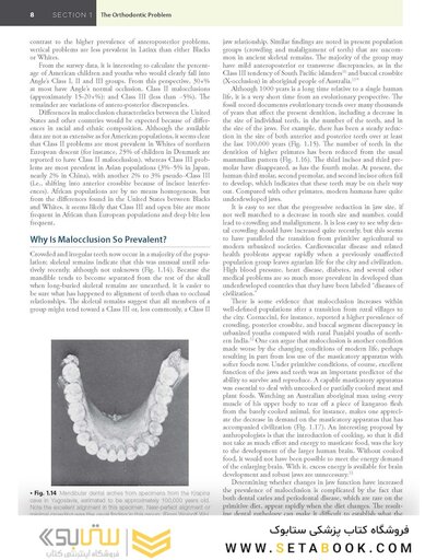 Contemporary Orthodontics 7th Edition