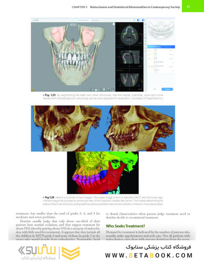 Contemporary Orthodontics 7th Edition