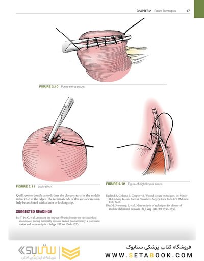 Hinman's Atlas of Urologic Surgery 5th Edition