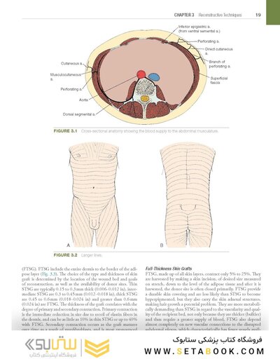 Hinman's Atlas of Urologic Surgery 5th Edition