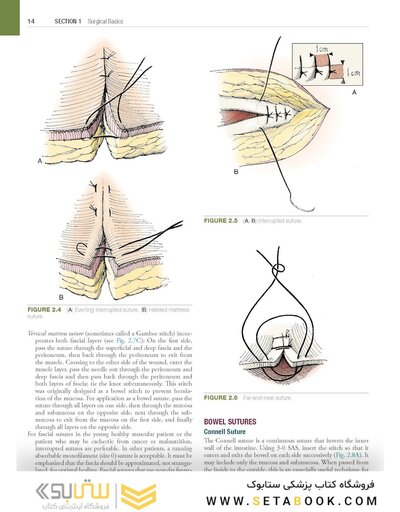 Hinman's Atlas of Urologic Surgery 5th Edition