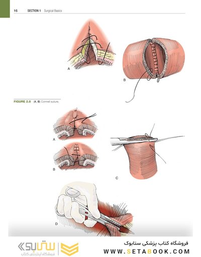 Hinman's Atlas of Urologic Surgery 5th Edition